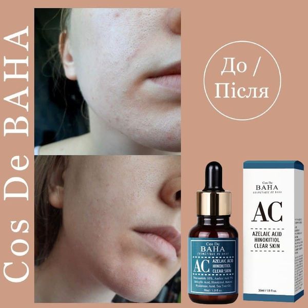 Сыворотка для проблемной кожи Cos De Baha Azelaic Acid Hinokitiol Clear Skin 17695 фото