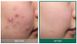 Восстанавливающий крем для проблемной кожи Some By Mi AHA-BHA-PHA 30 Days Miracle Cream 10566 фото 3