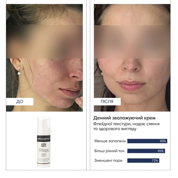 Дневной крем флюид с SPF 30 Braderm AZN Cream, 30 мл 18823 фото